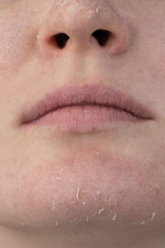 Young Girls Are Using Anti-Aging Products They See on Social Media: The Harm Is More Than Skin Deep