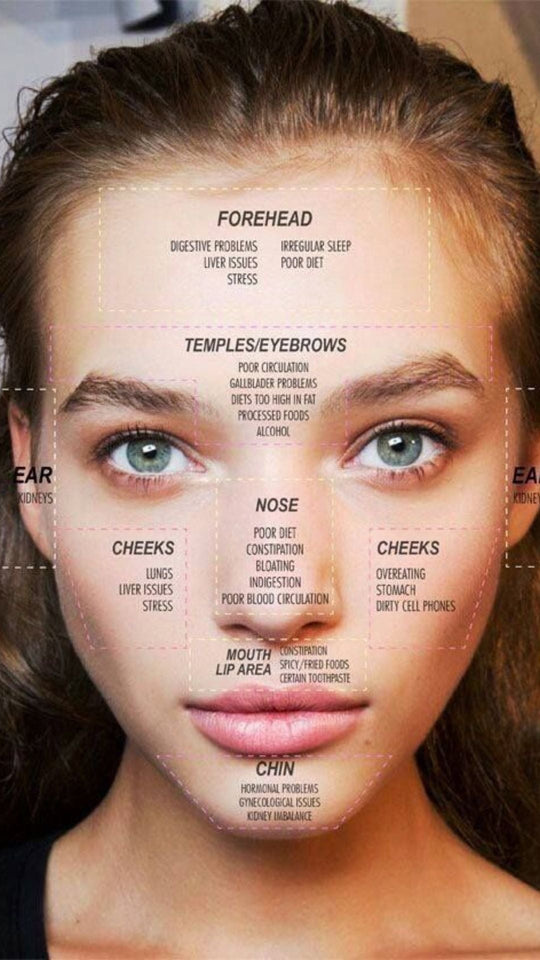 How to Know if You Have Stress Acne: Understanding the Link Between Stress and Your Skin