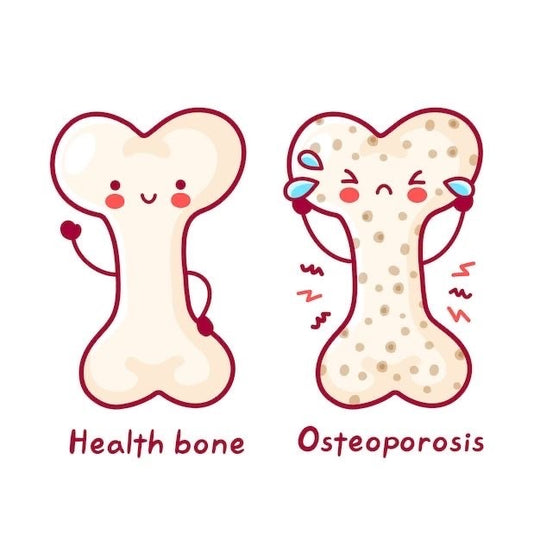 Collagen for Osteoporosis: Exploring Its Potential Benefits