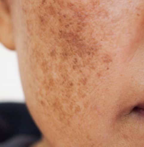 Dull and Pigmented Skin: Causes, Connection & Skin Care Tips – INJA ...